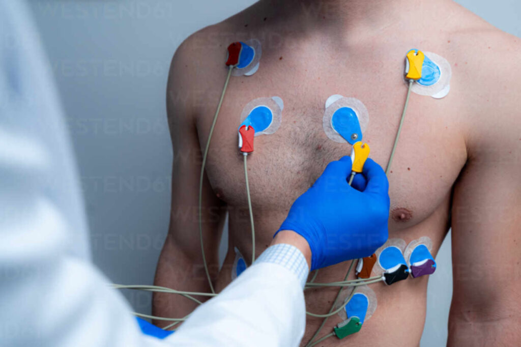 Electrocardiograma